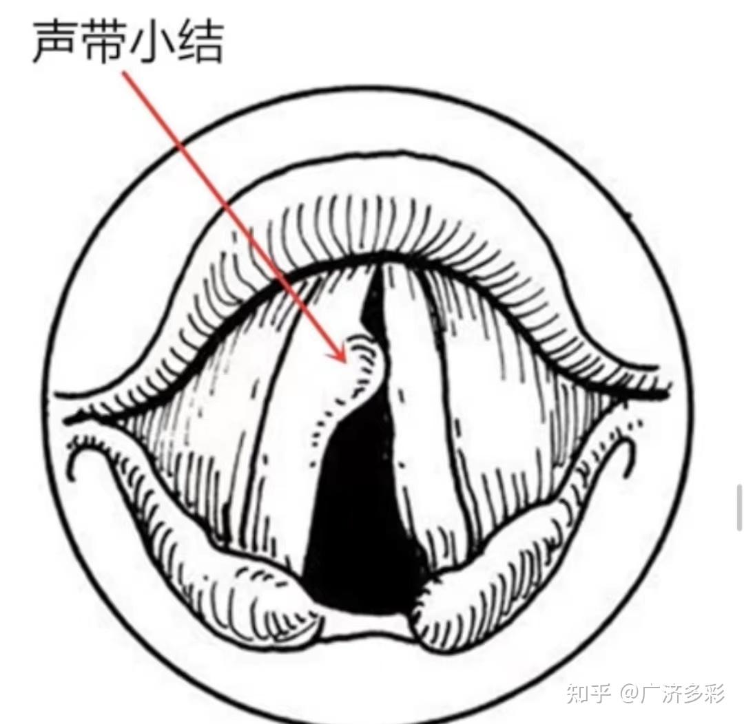 2.2声音的特点—人教版八年级数学下册讲义